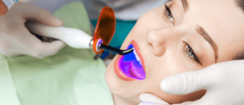 Laser Teeth Whitening dubai