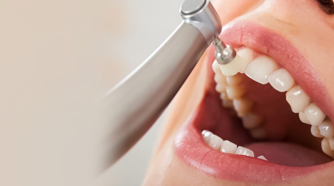 When To Book Your Appointment With Best Dentist?